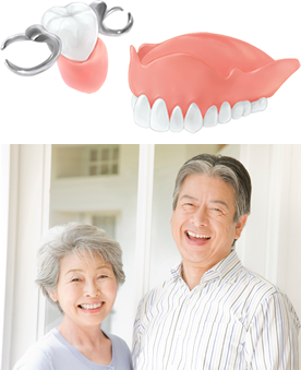 入れ歯（義歯）治療